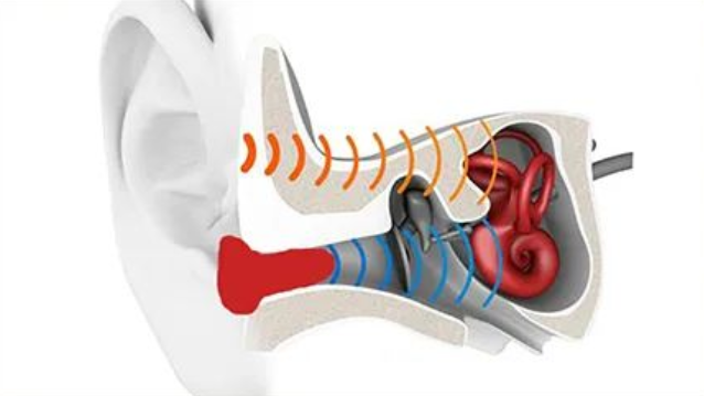 【听力科普】堵耳效应——堵住声音的退路(图3)