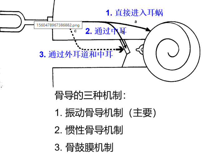 【听力科普】堵耳效应——堵住声音的退路(图4)