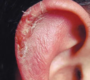 【听力科普】从零开始的日常听力保健（外耳篇）(图2)