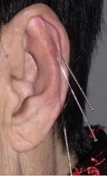 【听力科普】从零开始的日常听力保健（外耳篇）(图4)