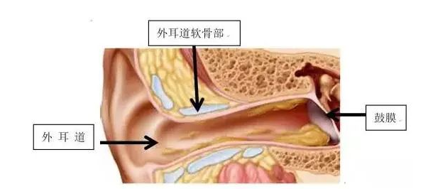 【听力科普】从零开始的日常听力保健（外耳篇）(图5)