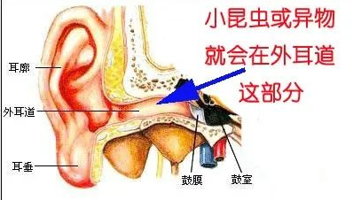 【听力科普】从零开始的日常听力保健（外耳篇）(图7)